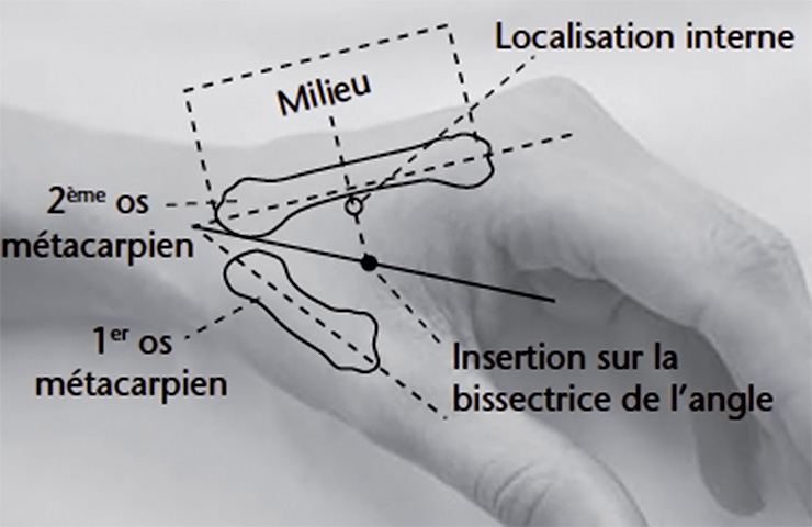Point d'acupuncture GI4
